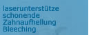 Laserunterst�tzte schonende Zahnaufhellhung