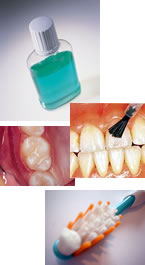 Fluoridierung